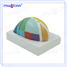 PNT-0621 Enlarged Thalamus model brain model